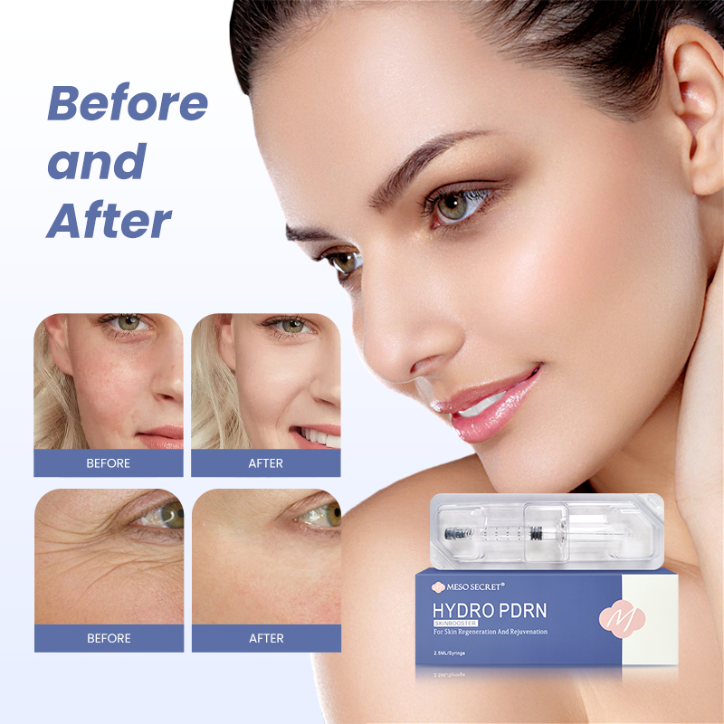 Meso Secret Hydro PDRN Injectable Skinbooster for Skin Rejuvenation