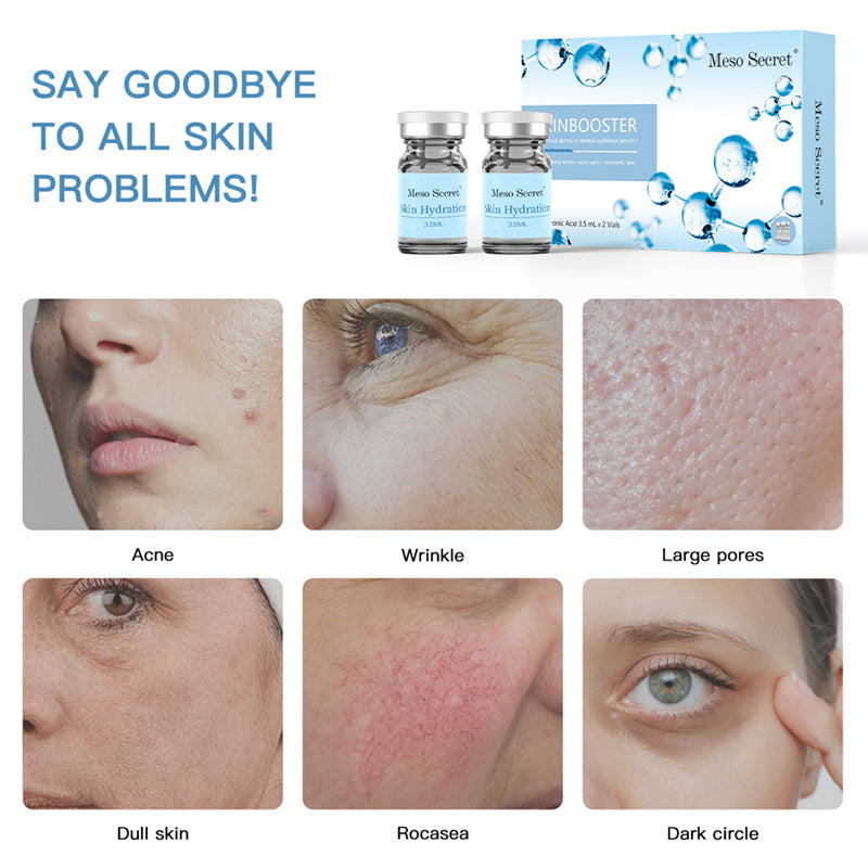 Meso Secret Injectable Skinbooster Skin Hydration Essence