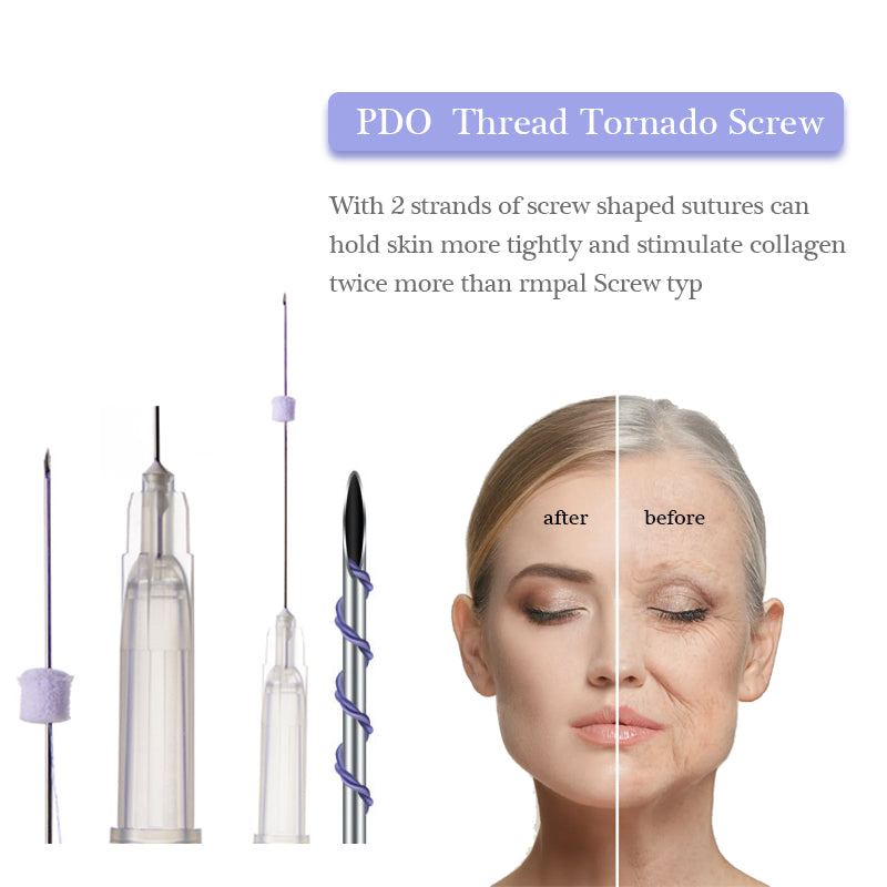 PDO Screw Threads for Lip Smoker Lines Nasolabial Folds Cheek Face Filling