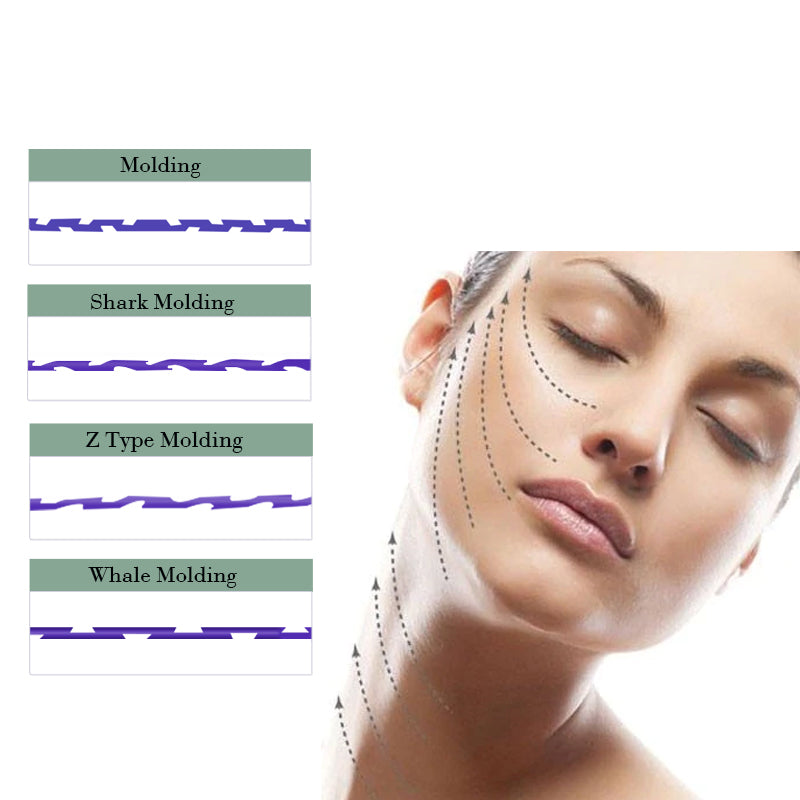 PDO Z Type /Whale /Shark Molding Thread for Glabella Face Abdomen Breast Neck Lifting