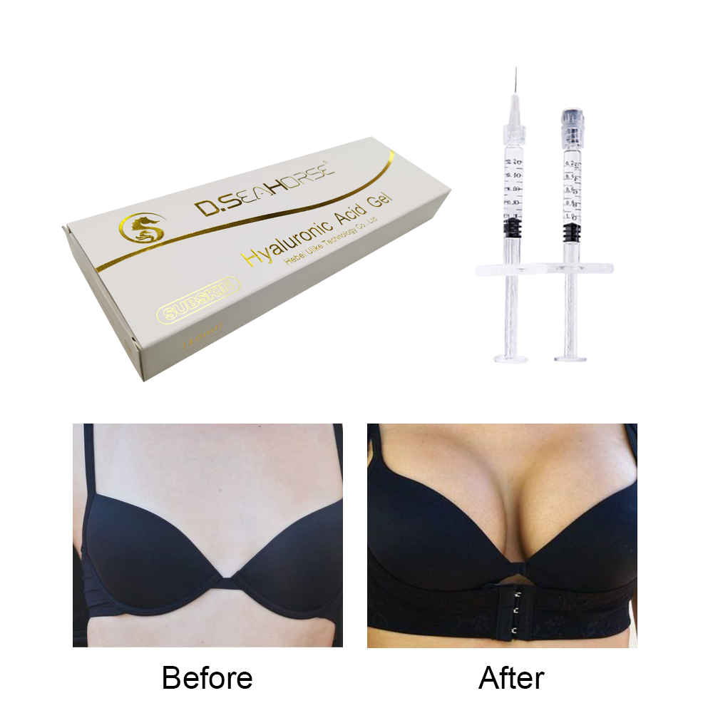 “Subskin” D.seahorse Hyaluronic Acid Filler 10ml for Buttock Breast Penis Filler