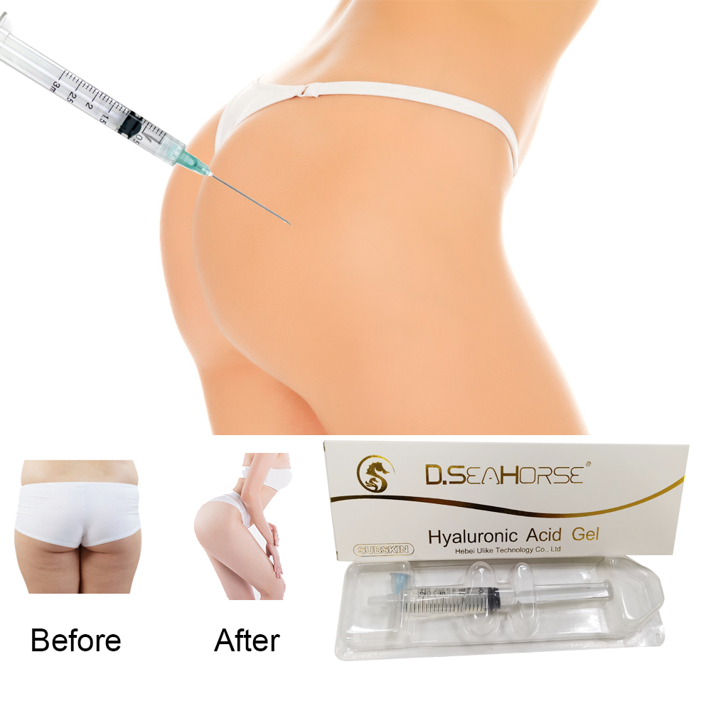“Subskin” D.seahorse Hyaluronic Acid Filler 10ml for Buttock Breast Penis Filler