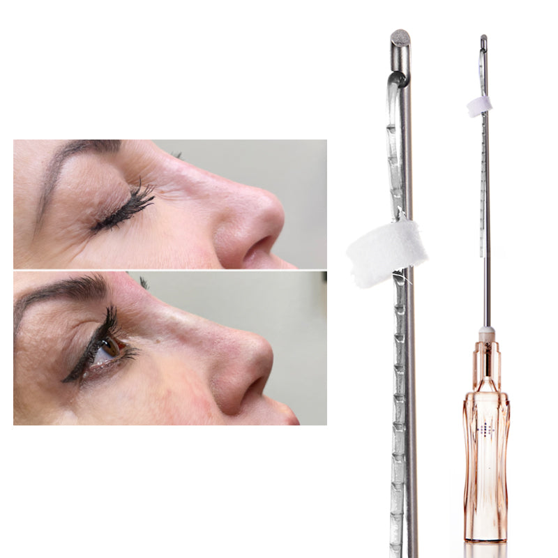 PCL Nose Threads L type Cannula 19g 38mm 60mm