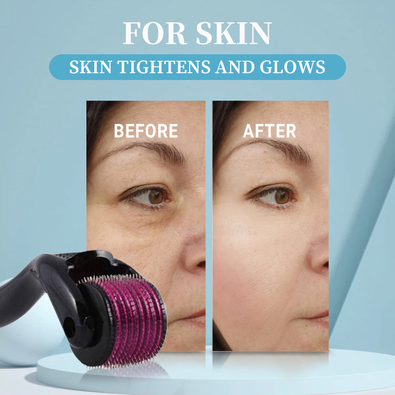 Dermal Roller 540 Microneedling Roller for Hair Beard Face Skin
