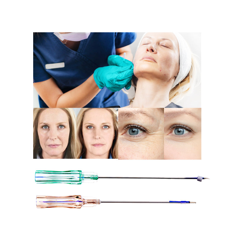 PDO Barbed Cog Threads for Upper Face Eyebrow Foreheard Cheek Nasolabial Folds Jaw Lifting