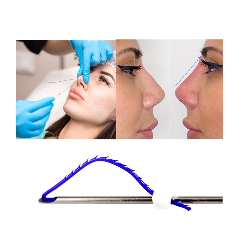 PDO Nose Thread for Nose Tip Bridge Lifting
