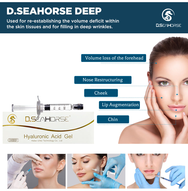D.seahorse Hyaluronic Acid Filler Injectable Filler Lip Filler Under Eye Filler Chin and Cheek Filler Jawline Filler Nasolabial Folds Filler Nose and Hand Filler