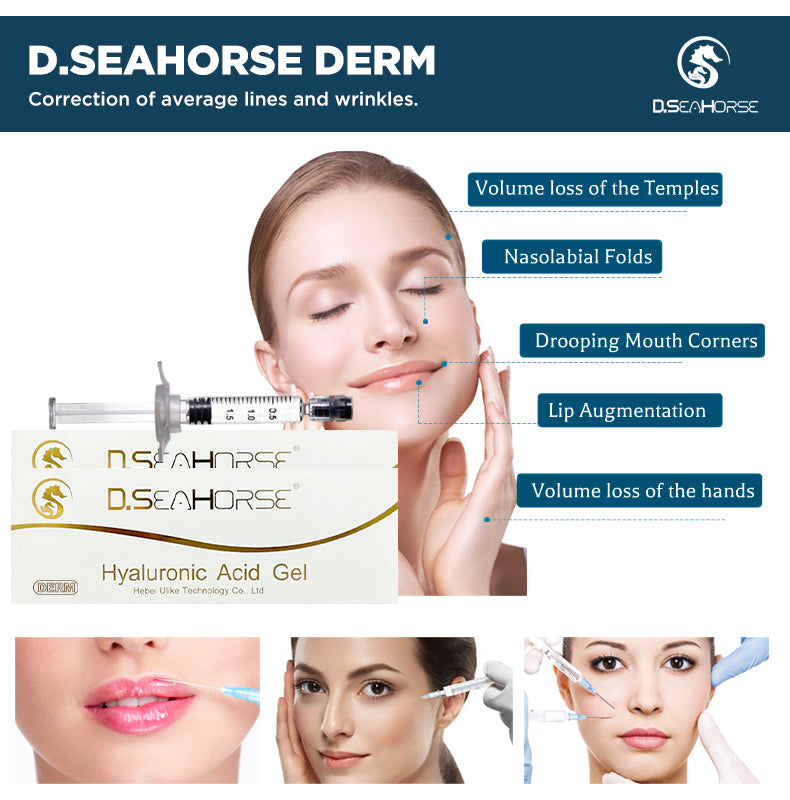 D.seahorse Hyaluronic Acid Filler Injectable Filler Lip Filler Under Eye Filler Chin and Cheek Filler Jawline Filler Nasolabial Folds Filler Nose and Hand Filler