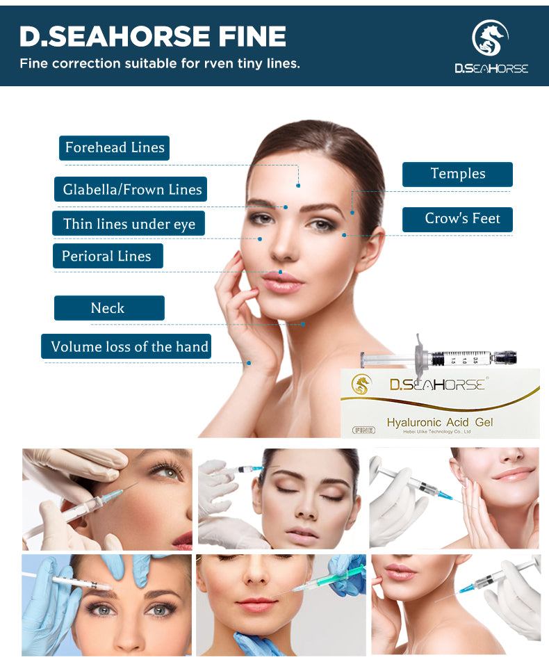 “Fine” D.seahorse Hyaluronic Acid Filler for Forehead Glabella Under Eye Neck Hand Temples Crow`s Feet Filler